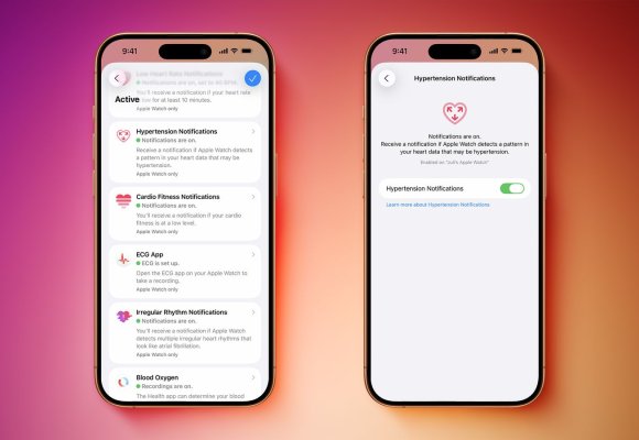 Apple Watch wykrywa nadciśnienie – nowa funkcja zdrowotna